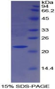 Human PON1 / ESA Protein (Recombinant His)