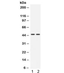CTSK / Cathepsin K Antibody