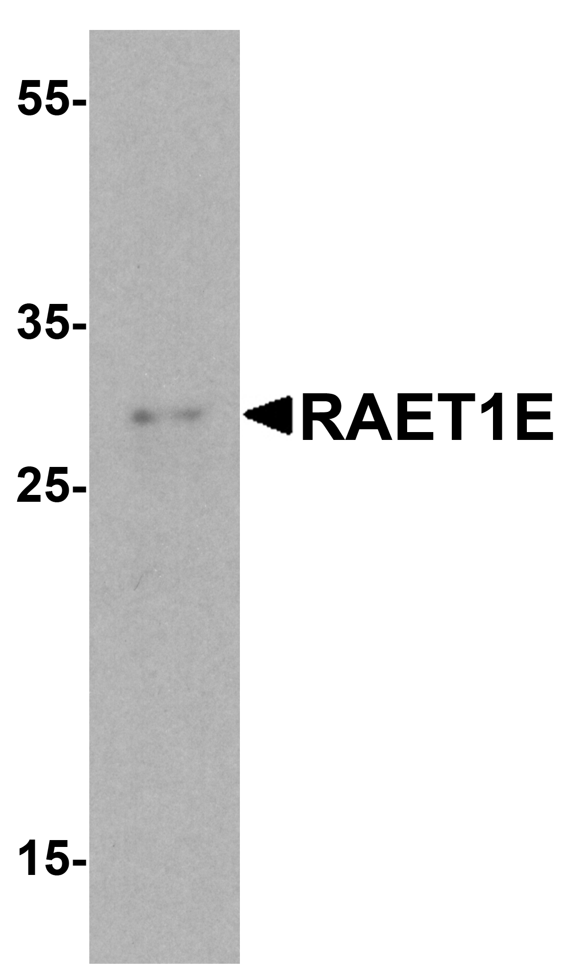 IHC-plus™ NKG2DL4 / ULBP4 Antibody