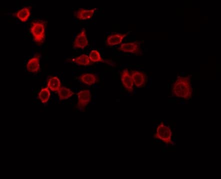 Polyclonal Rabbit anti-Human TRIM38 Antibody (IF, WB)
