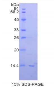 Human PIN4 Protein (Recombinant His)