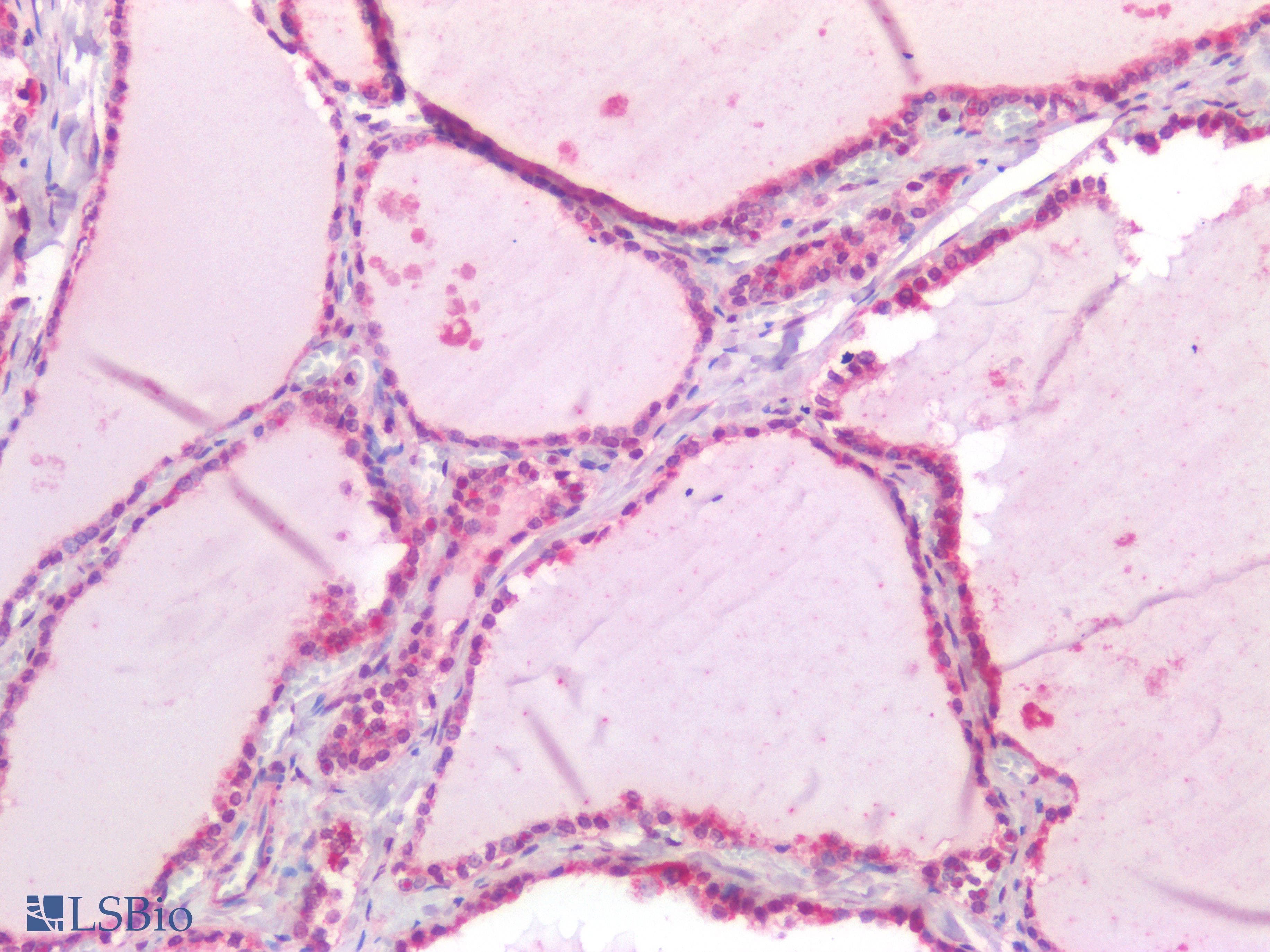 PathPlus™ LAMA1 / Laminin Alpha 1 Antibody