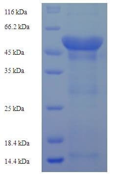 Human FBXL18 Protein (Recombinant His-SUMO)
