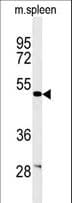 IHC-plus™ Polyclonal Rabbit anti-Human CORO6 Antibody (aa337-365, IHC, WB)