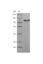 Vaccinia Virus Cell surface-binding protein (Recombinant 6His-SUMO, N-terminus)