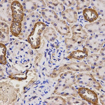 IHC-plus™ Polyclonal Rabbit anti-Human TAP2 Antibody (IHC, IF, WB)