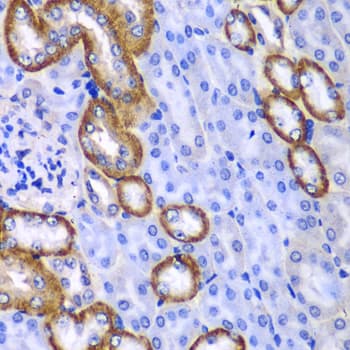 Polyclonal Rabbit anti-Human MYO1C Antibody (IHC, IF, WB)
