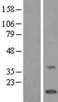 TMEM243 Protein (Over-Expression Lysate Myc-DDK (Flag))
