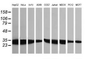 IHC-plus™ Monoclonal Mouse anti-Human GBAS Antibody (clone 1B8, IHC, IF, WB)