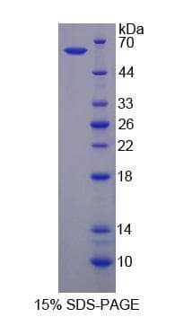 Human BCAR3 Protein (Recombinant His-GST)