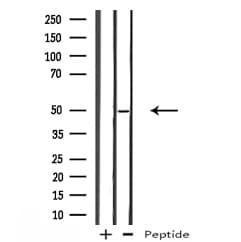 PLIN3 / M6PRBP1 / TIP47 Antibody