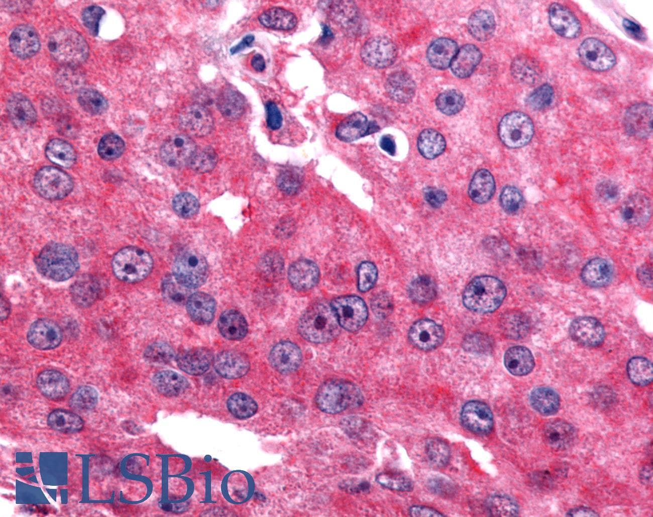 PathPlus™ ESRRB / ERR Beta Antibody (Ligand-binding Domain)