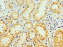 SIRT3 / Sirtuin 3 Antibody (aa20-130)