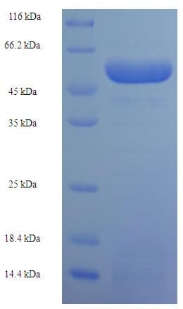Human SART3 Protein (Recombinant His-SUMO)