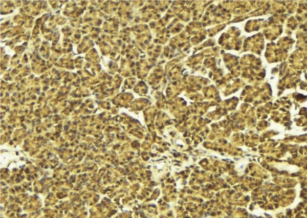 DUSP1 / MKP1 Antibody