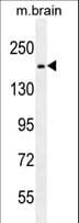 RB1CC1 / CC1 Antibody (aa489-515)