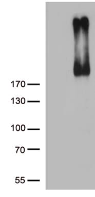 ERBB3 / HER3 Antibody (clone OTI1A6)
