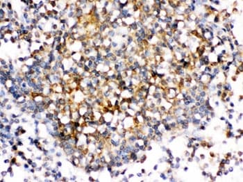 CD30L / CD153 Antibody