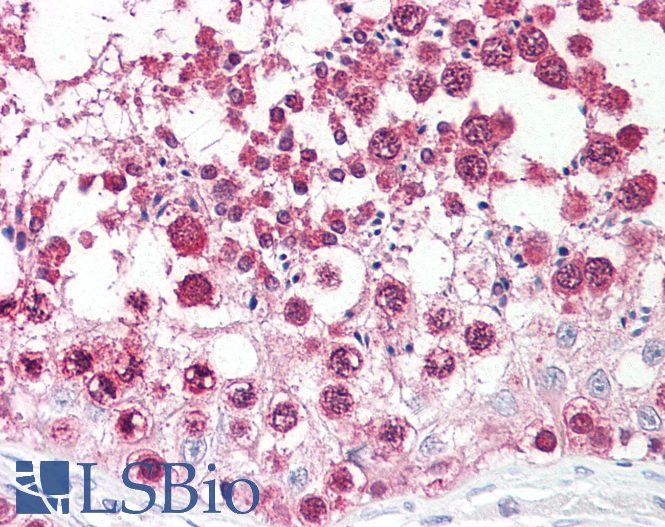 IHC-plus™ CSE1L Antibody (aa1-50)