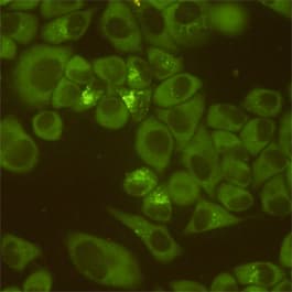 DDX3 / DDX3X Antibody