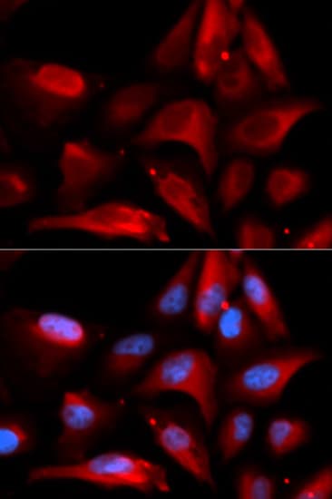 IHC-plus™ Calgizzarin / S100A11 Antibody