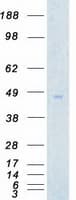 Human AURKA / Aurora-A Protein (Recombinant Myc-DDK (Flag))