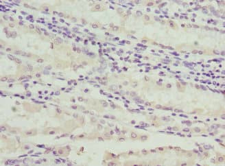 Polyclonal Rabbit anti-Human C1GALT1C1 Antibody (IHC, IF, WB)