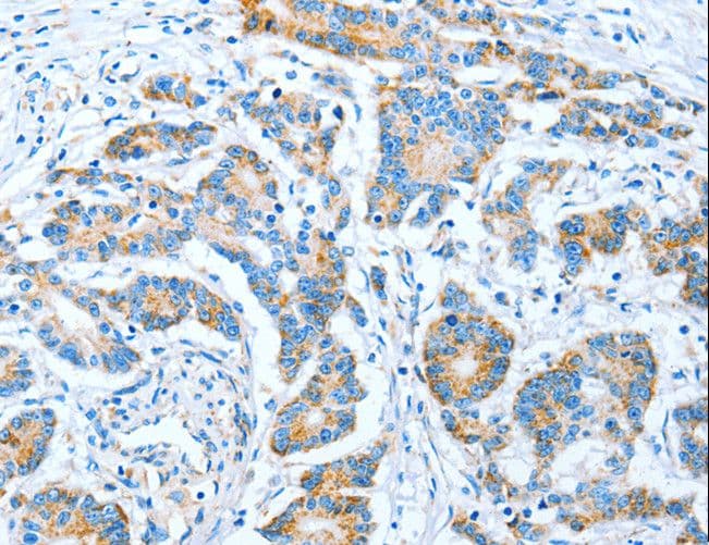 IMMT / Mitofilin Antibody
