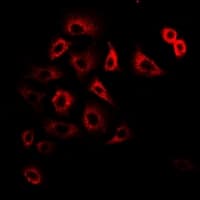 Polyclonal Rabbit anti-Human TIMM17A / TIM17 Antibody (IHC, IF, WB)