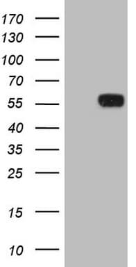 Monoclonal Mouse anti-Human Zfp105 / ZNF35 Antibody (clone OTI3D2, aa1-258, WB)