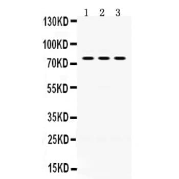 Polyclonal Rabbit anti-Human PAK7/PAK5 Antibody (aa26-55, IHC, WB)