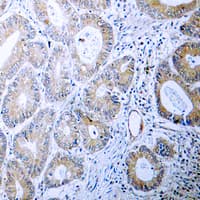 CALR / Calreticulin Antibody (N-Terminus)