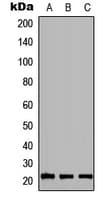 Polyclonal Rabbit anti-Human FTH1 / Ferritin Heavy Chain Antibody (Internal, WB)