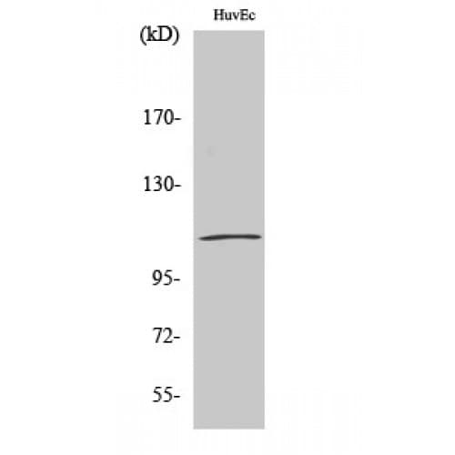 Polyclonal Rabbit anti-Human CTNND1 / p120 Catenin Antibody (180-260 aa, IHC, WB)