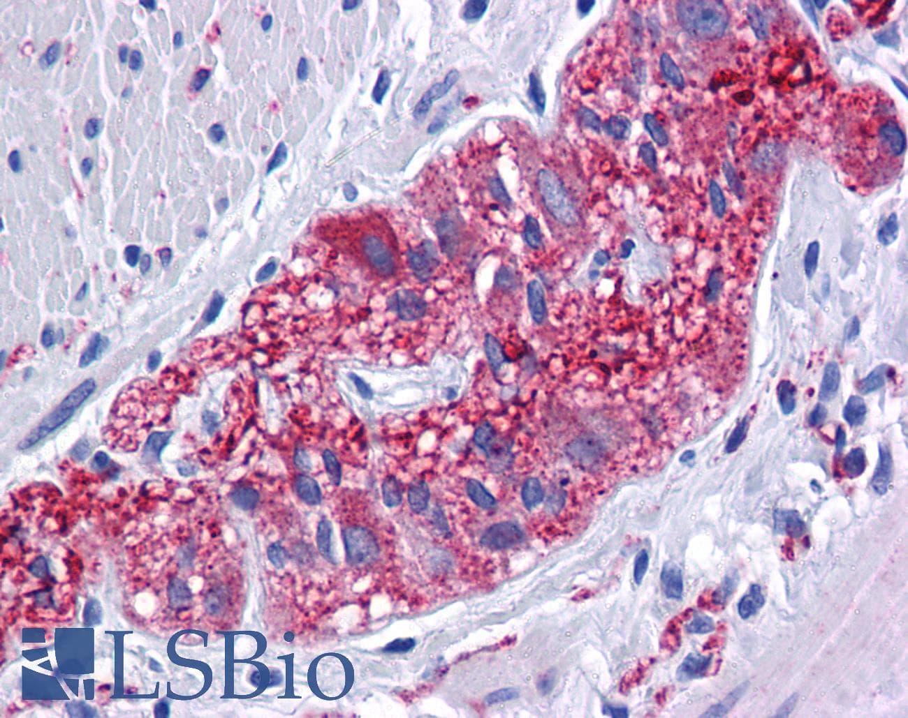 IHC-plus™ Polyclonal Rabbit anti-Human MFSD1 Antibody (IHC, WB)