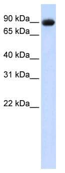 POSTN / Periostin Antibody (C-Terminus)