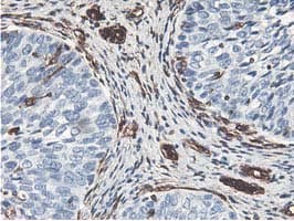 Latexin / MUM Antibody (clone OTI1E10)