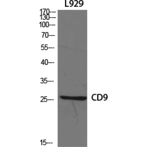 CD9 Antibody (70-150 aa, Internal)