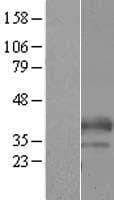 C19orf18 Protein (Over-Expression Lysate Myc-DDK (Flag))