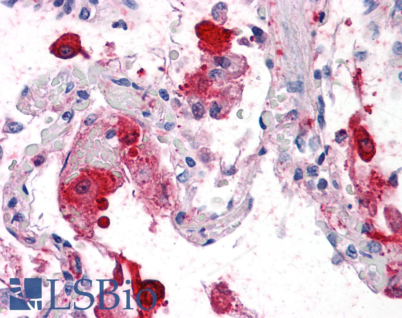 IHC-plus™ STX5 / Syntaxin 5 Antibody (clone 5A6)