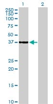IHC-plus™ CDK6 Antibody (clone 8H4)