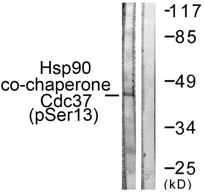 Polyclonal Rabbit anti-Human CDC37 Antibody (phospho-Ser13, IHC, WB)