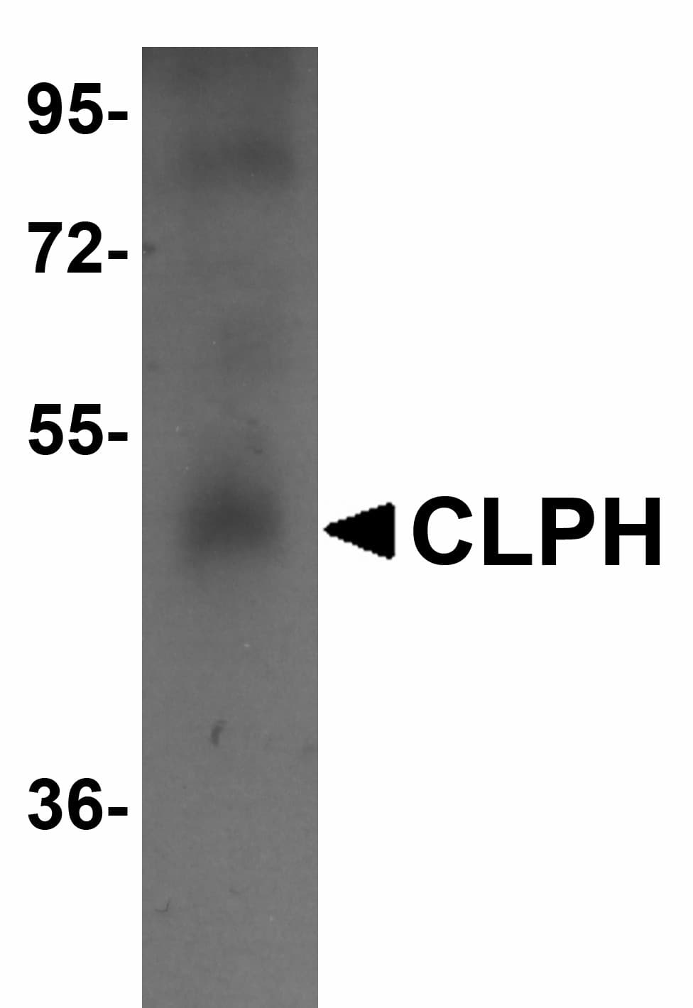 CABS1 Antibody