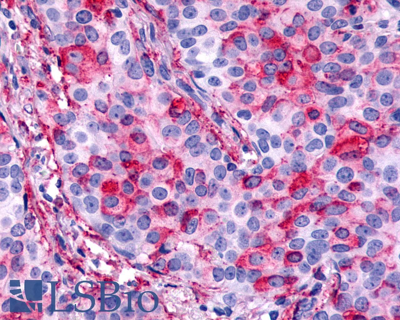 PathPlus™ CELSR1 Antibody (N-Terminus)
