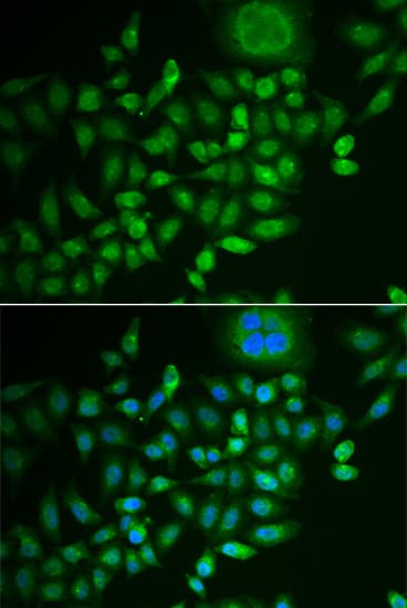 SCG2 / Secretogranin II Antibody