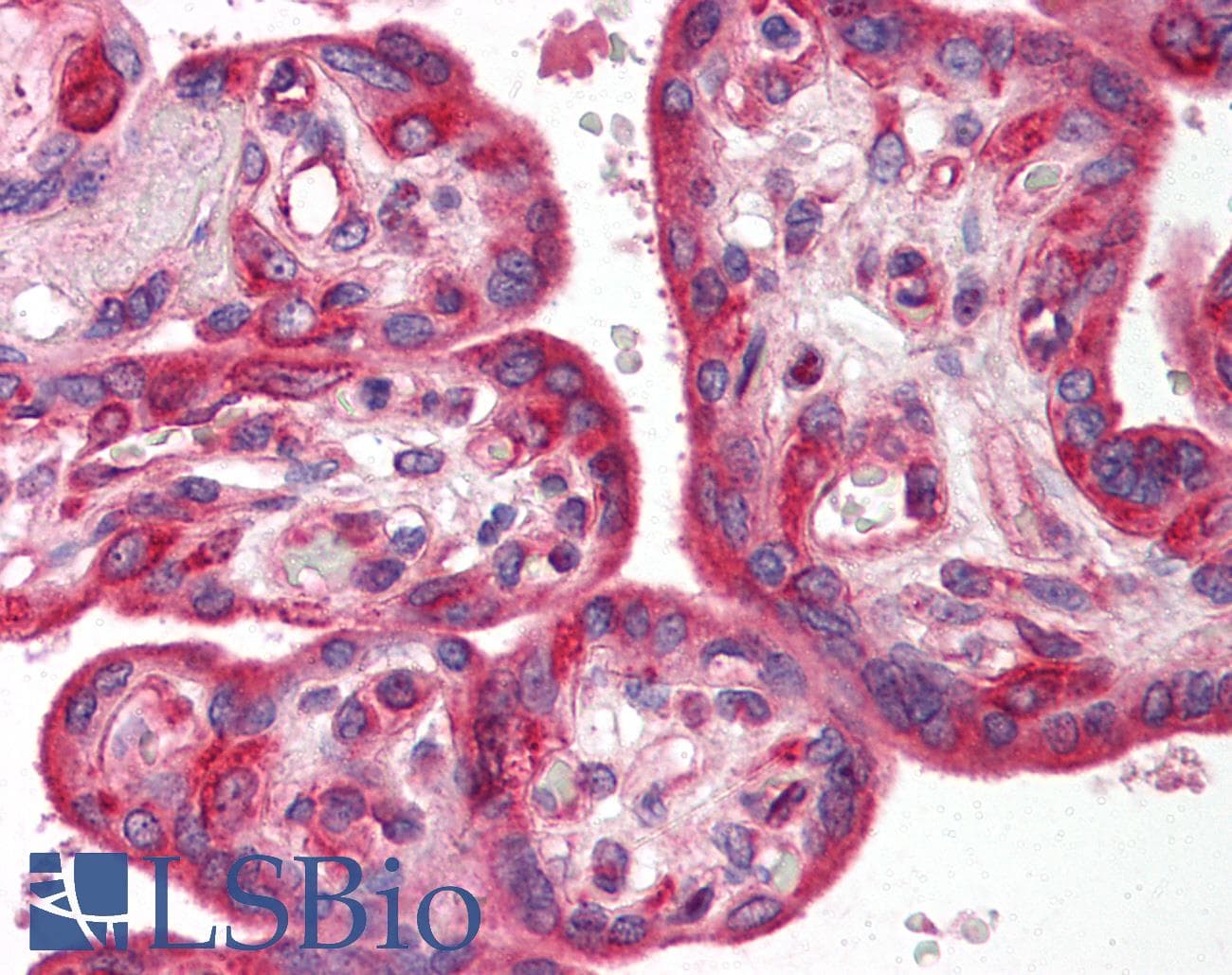 IHC-plus™ Polyclonal Rabbit anti-Human SKIL / SNO / SnoN Antibody (IHC, IF, WB)