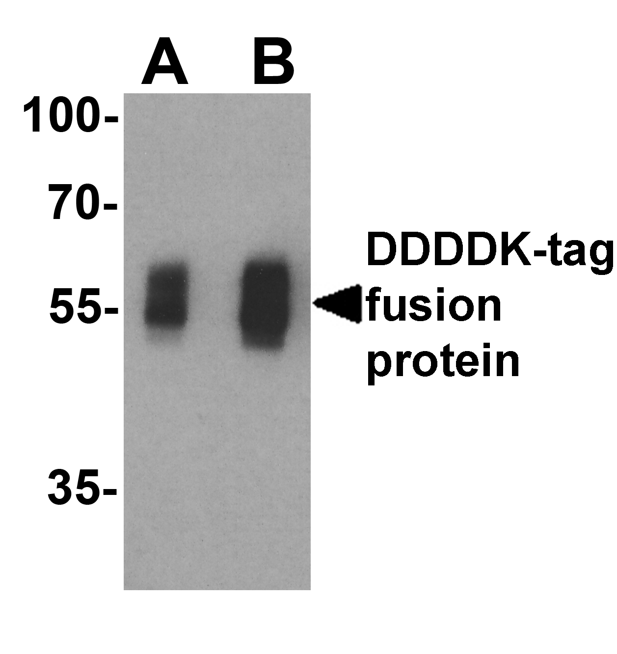 DDDDK Tag Antibody