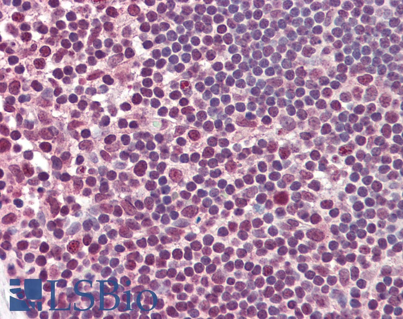 IHC-plus™ ELK3 / NET Antibody (aa323-372)