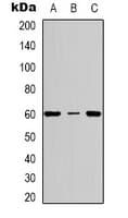CYBB / NOX2 / gp91phox Antibody (Internal)