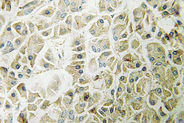 Polyclonal Rabbit anti-Human GZMH / Granzyme H Antibody (Gly75, IHC, IF, WB)